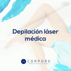 Depilacion laser