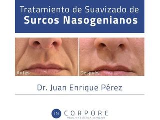Ácido hialurónico - Dr. Juan Enrique Pérez Enríquez