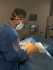 Aumento de pecho - Dr. Alejandro Sánchez Ródenas