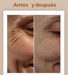 Dra. Andrea Tamargo - Eliminación de arrugas