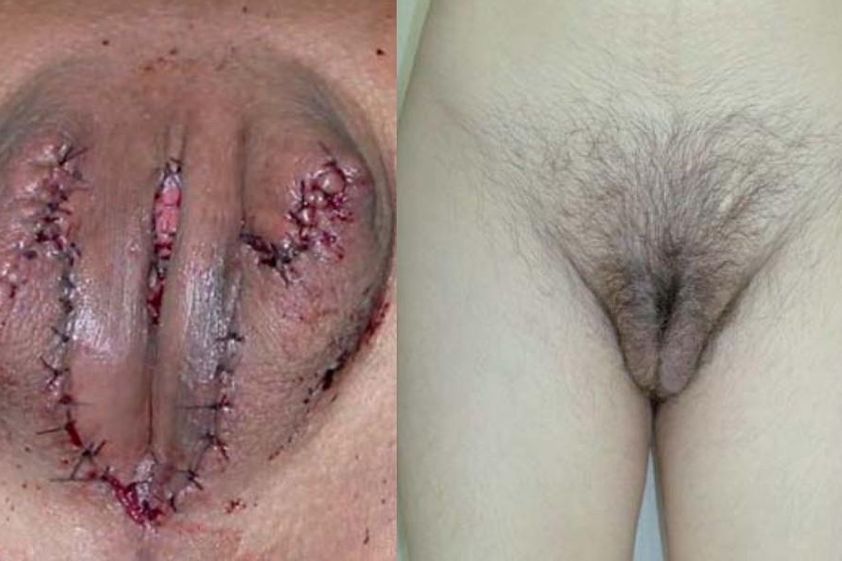 Cambio de sexo antes y después - 818407