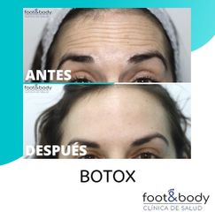 Bótox - Foot And Body