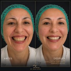 Rejuvenecimiento Facial - Clínica Dr. Omar López