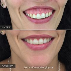 Clínica Dr. Omar López - Rejuvenecimiento facial