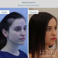 Femm Cirugía y Medicina Estética