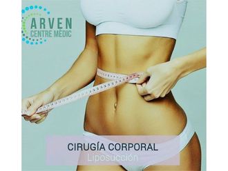 Liposucción - 630987