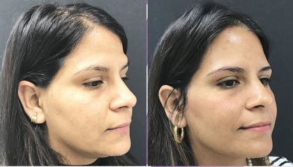 Clinica Dra. Margelis Cruces - Rejuvenecimiento