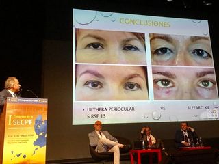 Dr. Jorge Alvarez Marín congreso cirugía plástica Rejuvenecimiento periocular