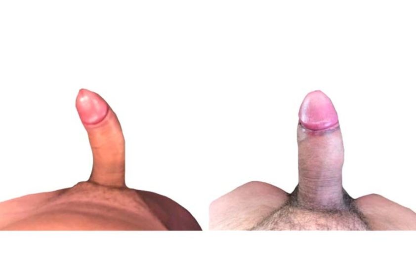 Cirugía reconstructiva antes y después - 811994