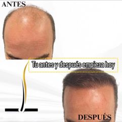 💎 Técnica Zafiro para resultados más precisos y cicatrización rápida.