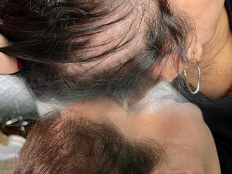 Tratamiento capilar antes y después - 877606