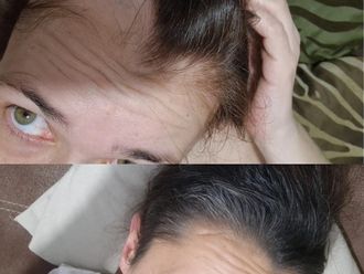 Tratamiento capilar antes y después - 880806