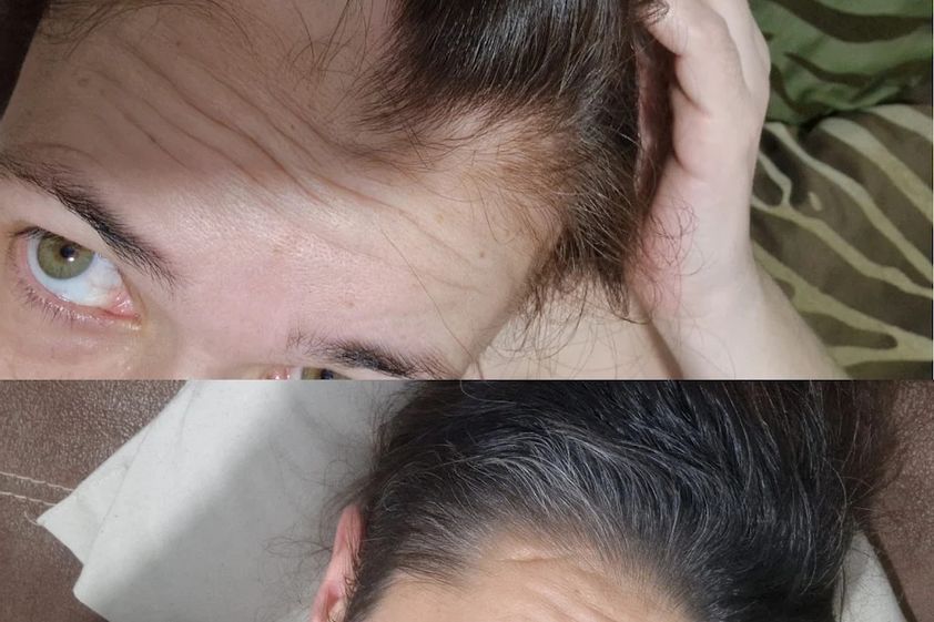 Tratamiento capilar antes y después - 880806