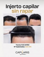 Fue Zafiro sin rapar