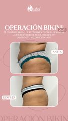 Operación Bikini