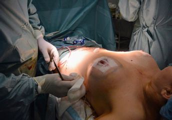 Dr. Enrique Linares Recatalá