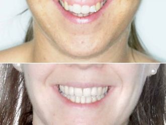 Cirugía maxilofacial - 647241