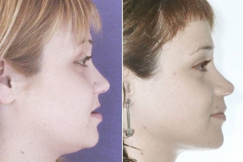 Ortodoncia antes y después - 738522