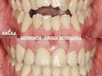 Ortodoncia - 738527