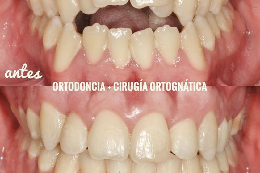 Ortodoncia antes y después - 738527