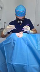 Blefaroplastia