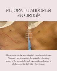 Abdomen