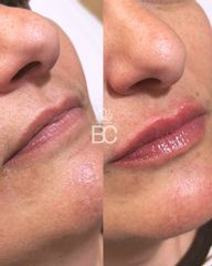 Labios