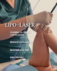 Lipoláser - Be Classy