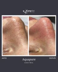 Aquapure - Cenydiet