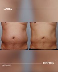 Este resultado no es de una sesión.  Es de un proceso.