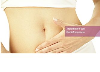 Radiofrecuencia