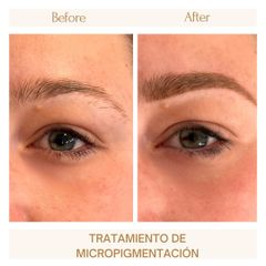 Micropigmentación - Clínica Amédic