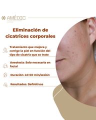 Eliminación de cicatrices corporales