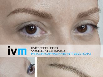 Micropigmentación - 622983