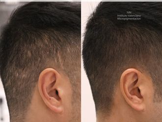 Tratamiento capilar - 630031