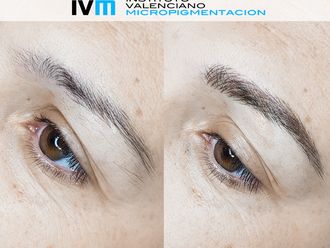 Micropigmentación - 631654