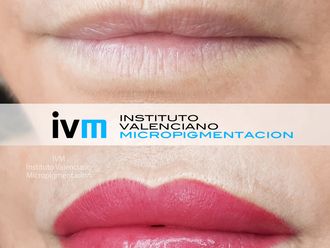Micropigmentación - 643093