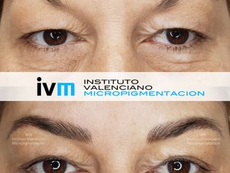 Micropigmentación - 646948