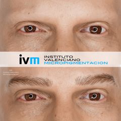Antes y después Micropigmentación de cejas - Instituto Valenciano Micropigmentación