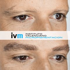Antes y después micropigmentacion cejas - Instituto Valenciano Micropigmentación