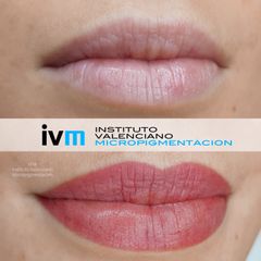 Antes y después Micropigmentación de labios