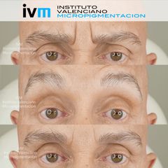 Instituto Valenciano Micropigmentación