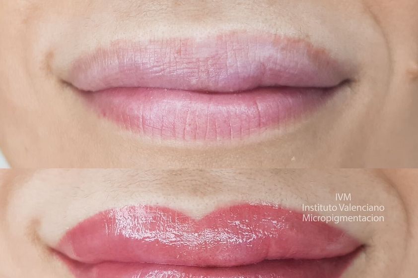 Micropigmentación antes y después - 835887