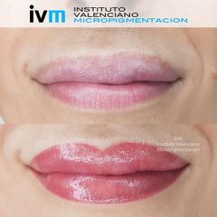 Micropigmentación - Instituto Valenciano Micropigmentación
