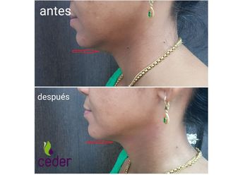 Hilos tensores - 634352