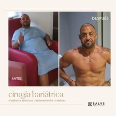 Tratamiento obesidad - Salus Medical Clinic Granada