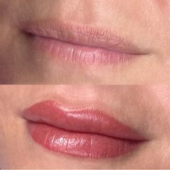 Micropigmentación de labios_ clínica o'nay santiago de compostela