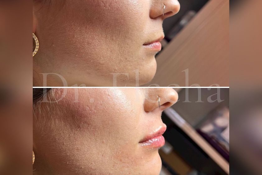 Cirugía maxilofacial antes y después - 838369