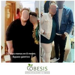 Bypass gástrico - Clínica Obesis