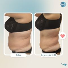 Presoterapia - Medcare Health & Beauty